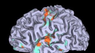 Riscritta la storia dell'evoluzione del cervello