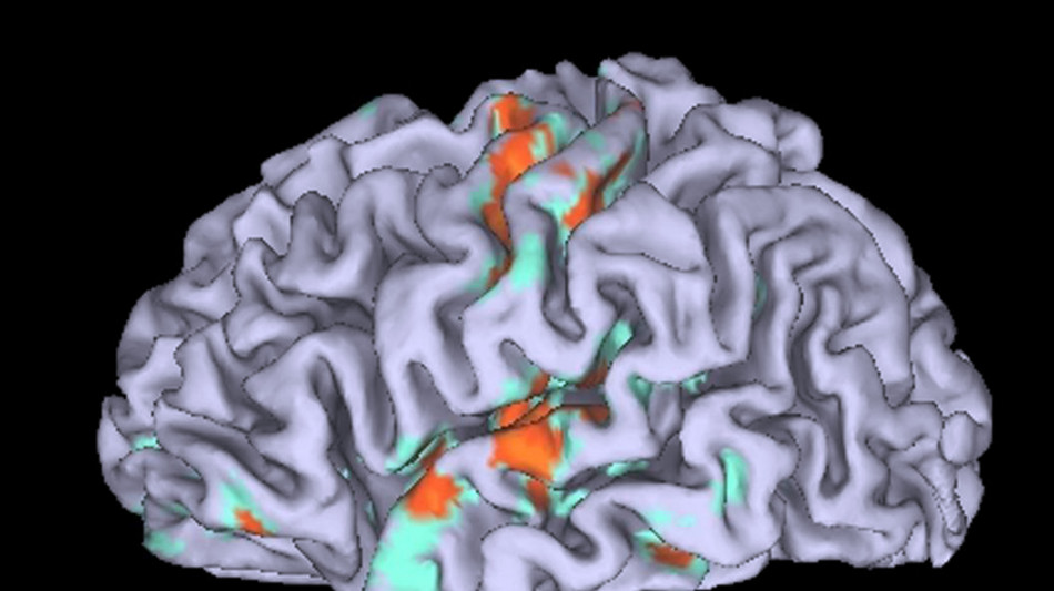 Scoperte le proteine che plasmano le differenze dei cervelli