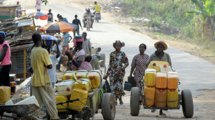 Guinea anuncia un caso de fiebre de Lassa en el sur del país