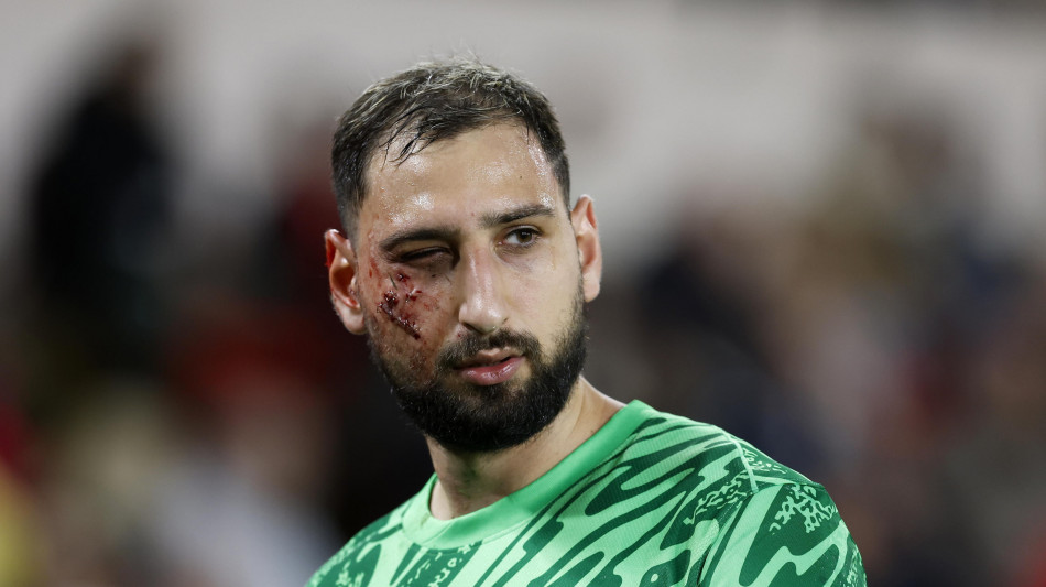 Psg, 'Donnarumma trauma facciale con ferite multiple'