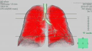 Australia proibisce uso della pietra composita, provoca silicosi