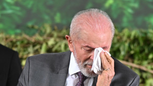 Previsti nuovi esami per Lula dopo un incidente domestico